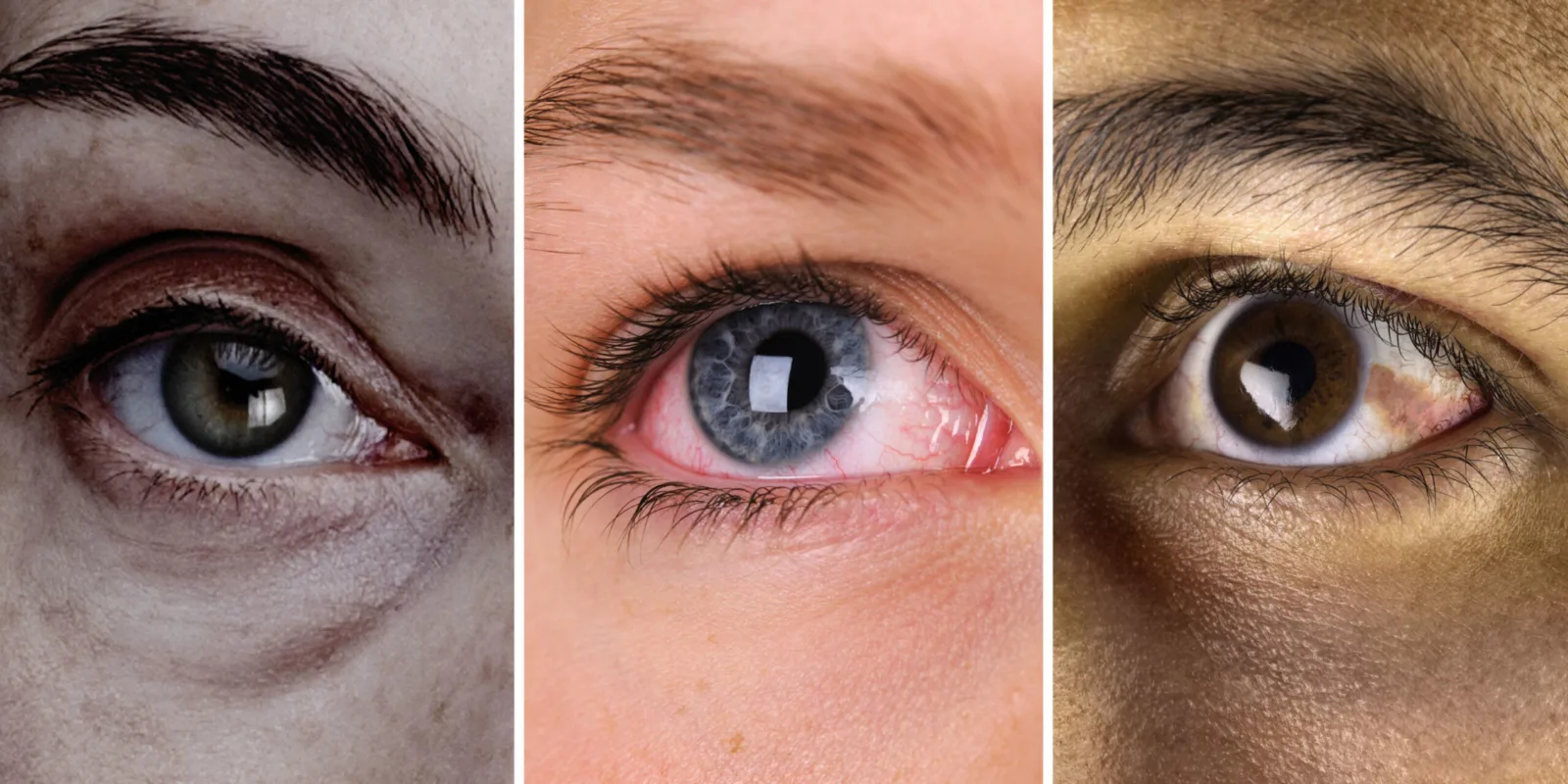 Kişiselleştirilebilir görme deneyimi sunan girişim: From Your Eyes