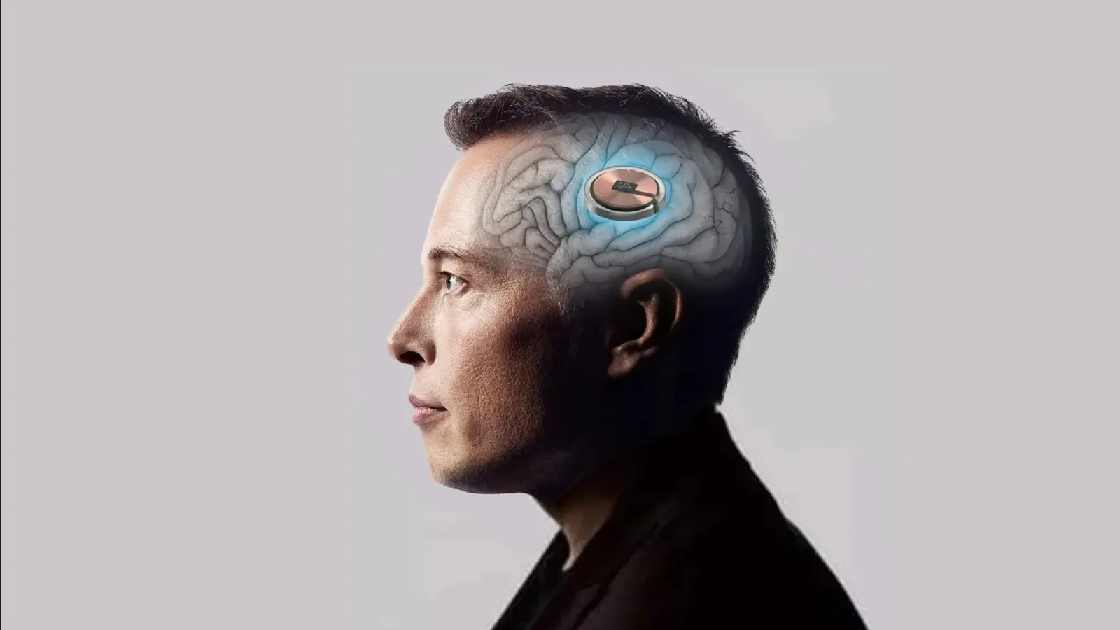 İnsan deneylerine başlayan Neuralink, 43 milyon dolar daha yatırım aldı